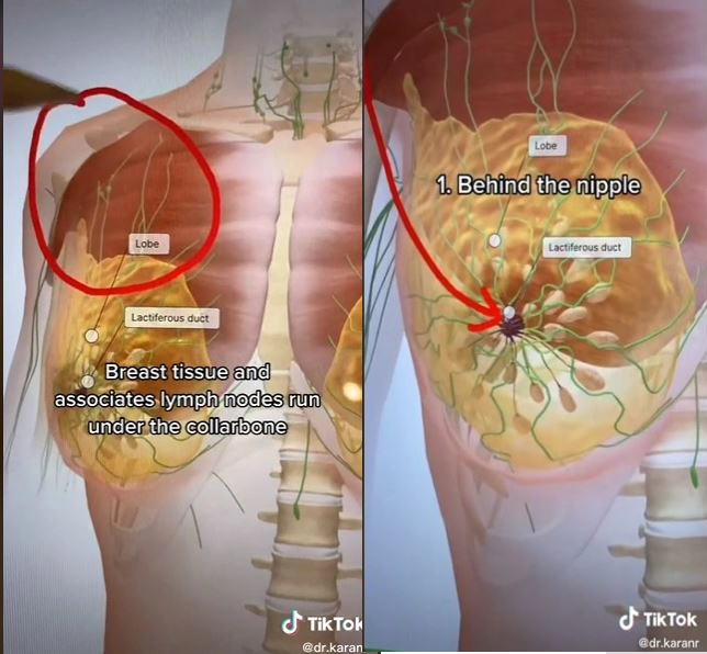 Bác sĩ cảnh báo về những điểm mù trong kiểm tra ung thư vú tại nhà thường bị bỏ qua - Ảnh 2.