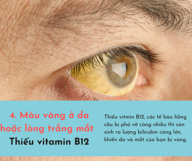 Cơ thể bị cạn kiệt vitamin sẽ phát ra 6 dấu hiệu, chủ quan bỏ qua có thể tổn thọ - Ảnh 4.