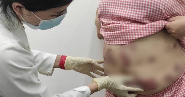 Quý bà tan nát cơ thể vì mê làm đẹp cấp tốc - Ảnh 3.