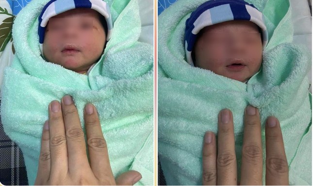 Bé sơ sinh bị bỏ rơi trước trụ sở UBND phường ở TP.HCM - Ảnh 1.