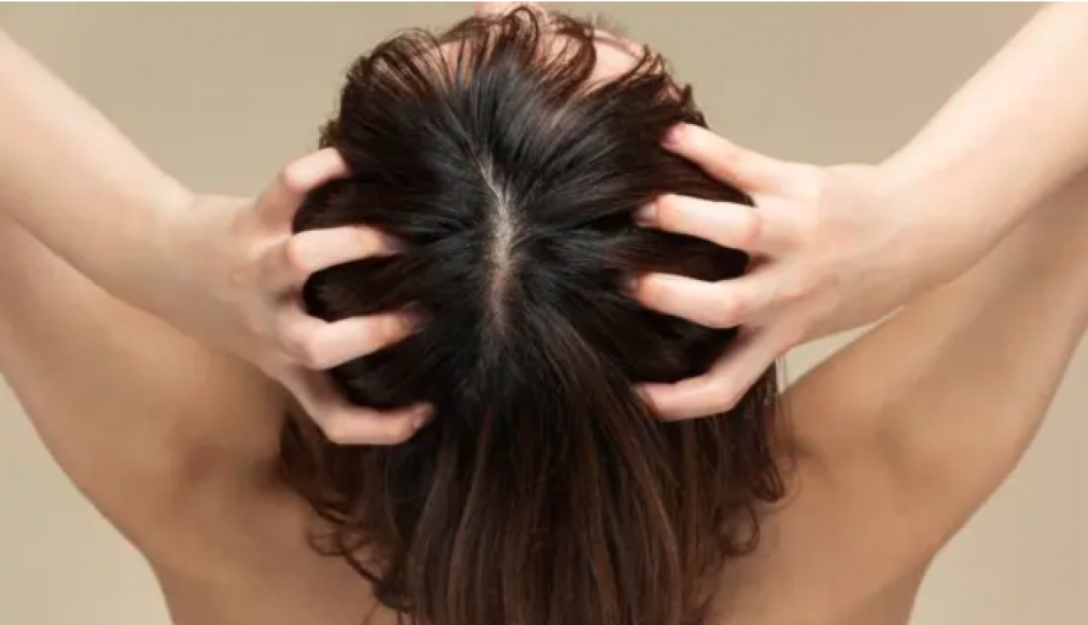 Ngăn ngừa các vấn đề về tóc trong mùa đông với các mẹo này - Ảnh 6.