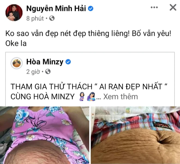 Sau bài đăng xác nhận chia tay, dân mạng xót xa nhìn lại hình ảnh những vết rạn bụng của Hoà Minzy lúc mang thai  - Ảnh 4.