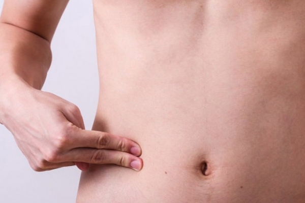 3 điểm bất thường ở bụng có thể liên quan đến bệnh ung thư, mong rằng bạn không có điều nào - Ảnh 3.