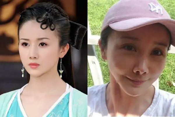 6 mỹ nhân mất sự nghiệp vì cuồng dao kéo: Trịnh Sảng hóa ra vẫn là ca nhẹ nhất, cô cuối nhìn mà khóc thét - Ảnh 5.