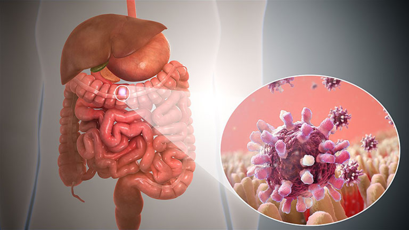 How long does it take to go from inflammation to cancer: there are 3 types of inflammation you absolutely must not ignore - Photo 4.