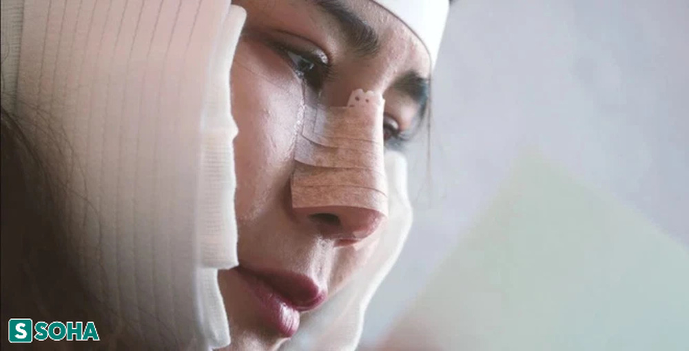 Being mocked as a monkey, the girl gritted her teeth to endure pain, underwent 5 major surgeries to change her life - Photo 3. Being mocked as a monkey, the girl gritted her teeth to endure pain, underwent 5 major surgeries to change her life - Photo 3.