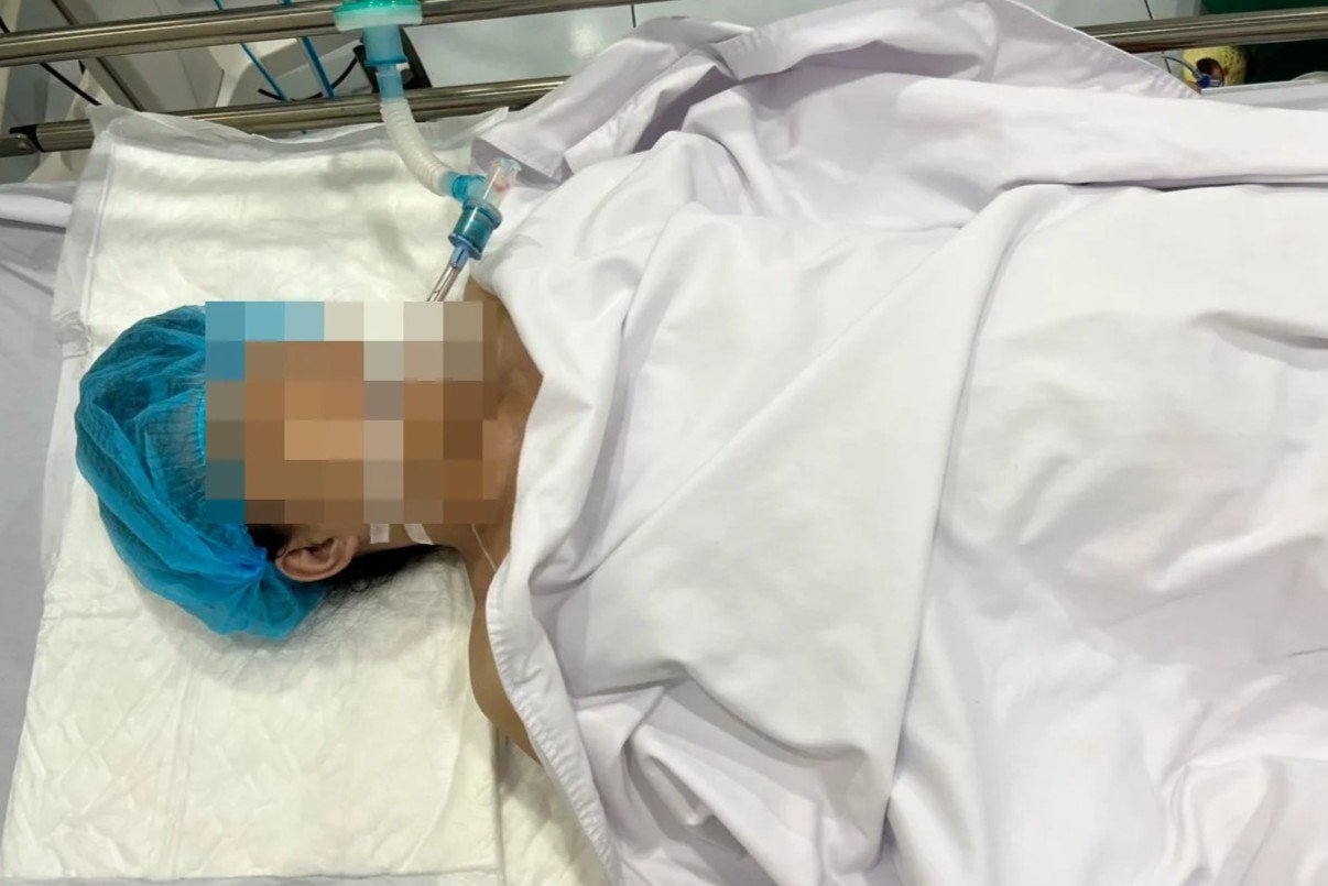 The woman in Ho Chi Minh City died after breast augmentation, her family was shocked when she arrived, the body was purple - Photo 1.