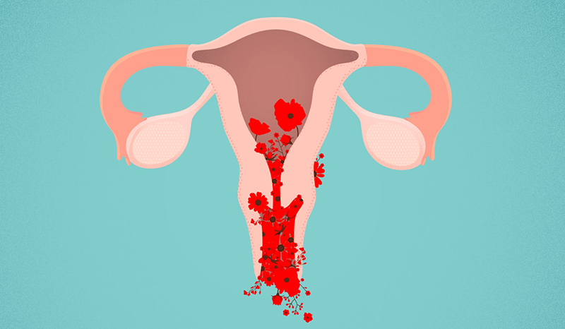 Nữ giới khi bị u xơ tử cung thường có 5 thay đổi trên cơ thể, mong rằng bạn không có điều nào - Ảnh 4.