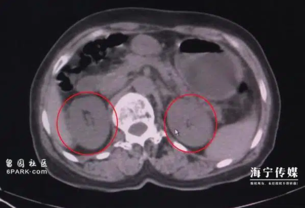 A woman with kidney failure after eating a favorite vegetable: The doctor warned that the following 5 vegetables have their own toxins, when processing should be very careful - Photo 2.