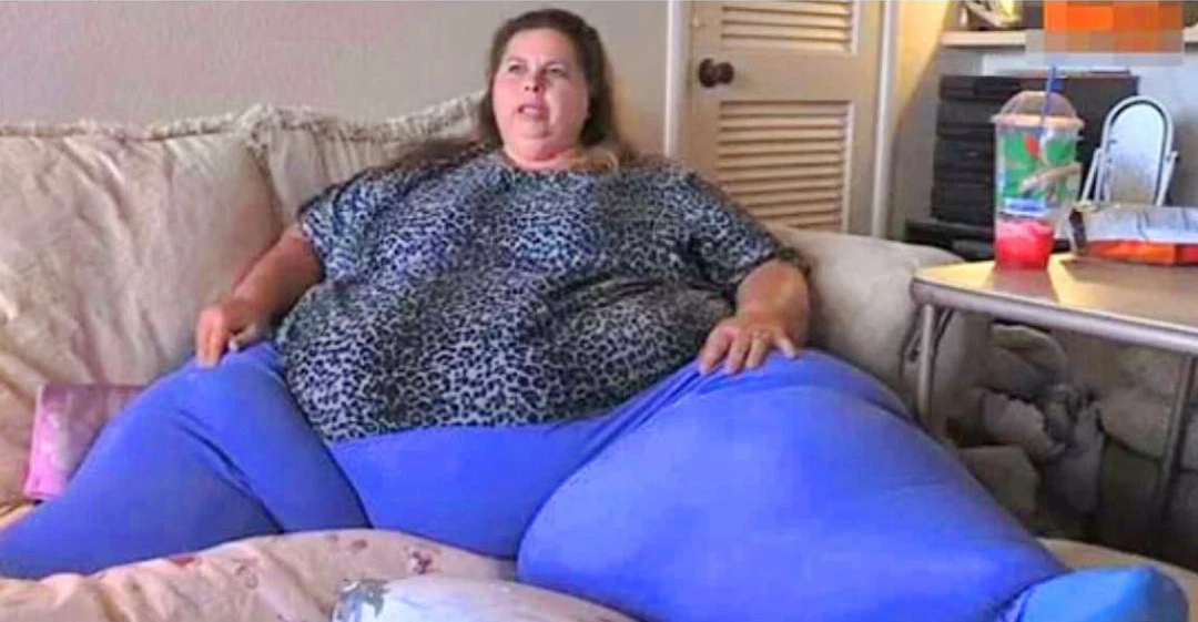 The fattest woman on the planet weighing 302kg can only walk with a shock 