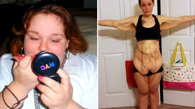 Determined to lose 152kg to make her daughter proud, the woman regrets her weird body and unbelievable transformation screen after that - Photo 1. Determined to lose 152kg to make her daughter proud, the woman regrets her weird body and unbelievable transformation screen after that - Photo 1.