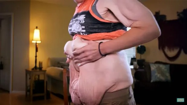 Determined to lose 152kg for her daughter to be proud of, the woman regrets her weird body and unbelievable transformation afterwards - Photo 2. Determined to lose 152kg for her daughter to be proud of, the woman regrets her weird body and unbelievable transformation afterwards - Photo 2.