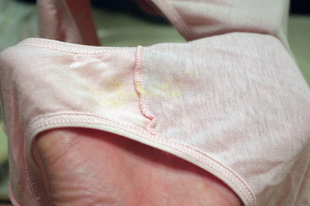 2 dấu hiệu bất thường trên quần lót là đặc điểm của bệnh ung thư cổ tử cung mà bạn có thể tự kiểm tra ngay - Ảnh 1.