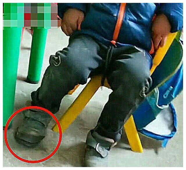 Thấy học trò cứ giậm chân trong lớp, giáo viên lại xem thì phát hiện 1 điều khiến cô đỏ hoe mắt: Sự việc sau đó gây bão mạng - Ảnh 1.
