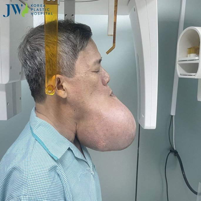 Race to save a man of 10 years with a giant tumor on his face - Photo 1.