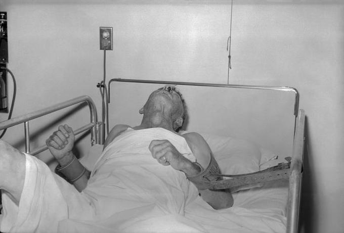The dangerous disease is common all over the world, the mortality rate is up to 100% - Photo 3. The dangerous disease is common all over the world, the mortality rate is up to 100% - Photo 3.