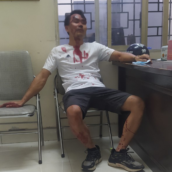 Hà Nội: Điều tra vụ người phụ nữ bị vợ cũ của chồng sắp cưới cùng nhóm đối tượng lạ mặt đánh sảy thai sau bữa tiệc sinh nhật con - Ảnh 2.
