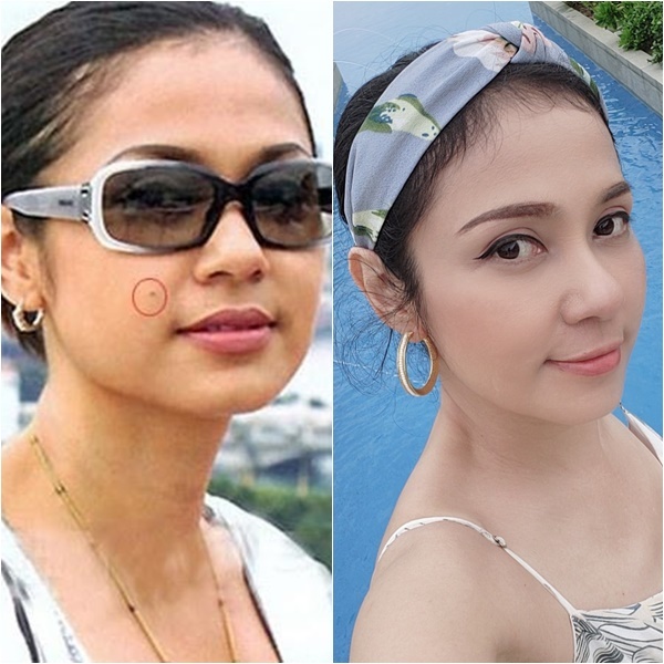 Để cuộc đời v&agrave; nhan sắc sang trang, sao Việt buộc phải loại bỏ chi tiết n&agrave;y tr&ecirc;n mặt - Ảnh 13.