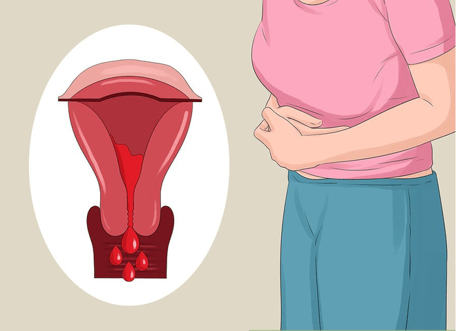 If you wake up in the morning, if you have 3 unusual problems, you should go to check your uterus right away - Photo 2.