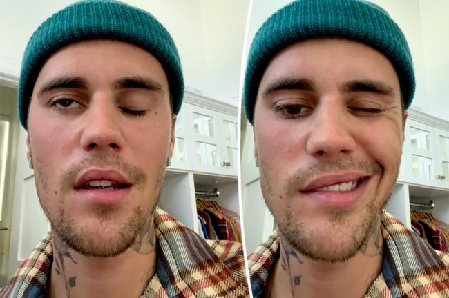 Justin Bieber rất hoảng sợ và lo lắng về tác dụng phụ của hội chứng gây liệt nửa mặt - Ảnh 1.