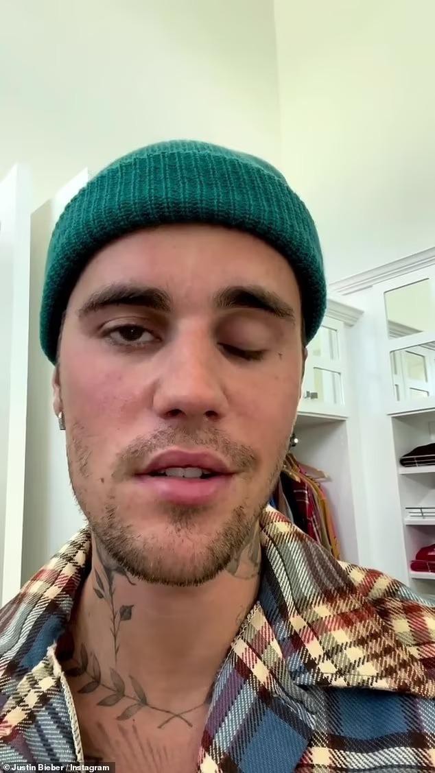 Bà xã diện mốt không nội y, khoe chân dài trên phố sau khi Justin Bieber tiết lộ bị liệt nửa mặt - Ảnh 7.