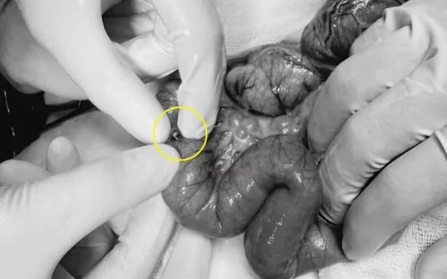 B&eacute; 3 tuổi thủng ruột v&igrave; m&oacute;n đồ chơi quen thuộc - Ảnh 1.