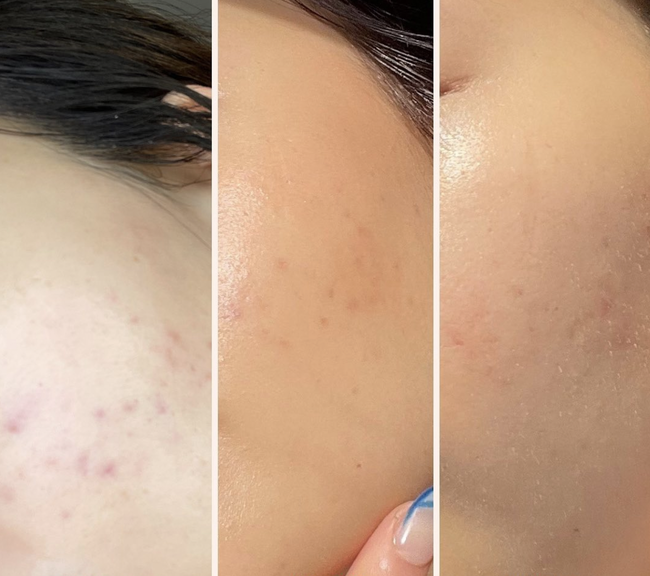 Thành phần dưỡng ẩm gấp 5 lần HA và Collagen, được bác sĩ da liễu khuyên dùng cho da lão hóa - Ảnh 3.