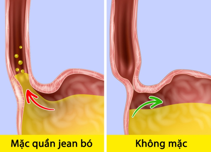 5 hậu quả tai hại khi mặc quần jean bó quá thường xuyên - Ảnh 3.