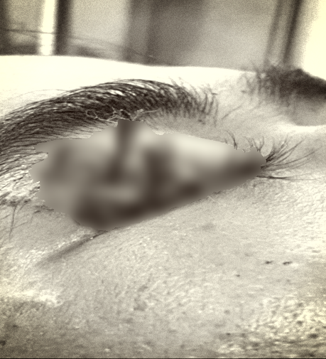 Saving hospitalized patients with a bamboo wand inserted deep into the eye socket - Photo 2.