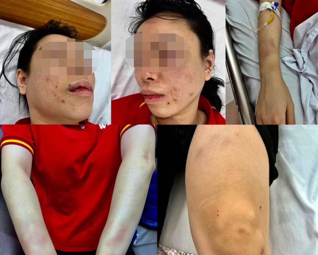 Người phụ nữ ở Hà Nội tố bị chồng cũ bắt cóc, đánh đập dã man - Ảnh 2.