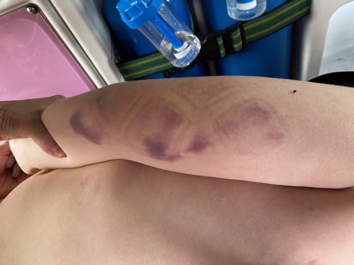 Phan Thiet City police are still investigating the case of a drowning Japanese boy - Photo 2. Phan Thiet City police are still investigating the case of a drowning Japanese boy - Photo 2.