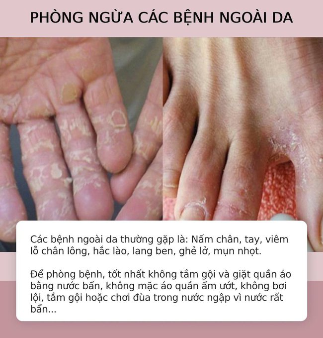 Những lưu ý đề phòng an toàn mùa mưa bão, phòng bệnh mùa mưa lũ - Ảnh 6.