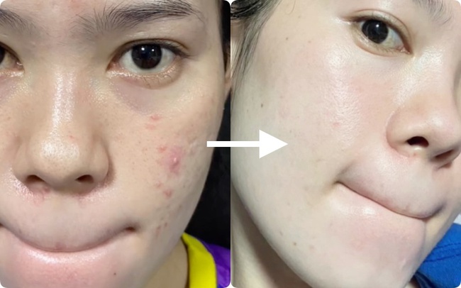 Xu hướng skincare năm 2023: Hồi sinh làn da lão hóa với 5 loại vitamin chủ chốt - Ảnh 1.