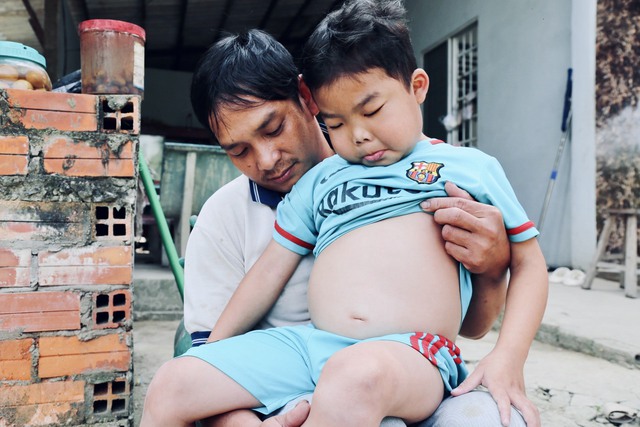 Mẹ bệnh kh&ocirc;ng d&aacute;m đi chữa trị, gom g&oacute;p tiền để cứu con trai 6 tuổi bị thận hư, ph&ugrave; nề khắp người - Ảnh 3.