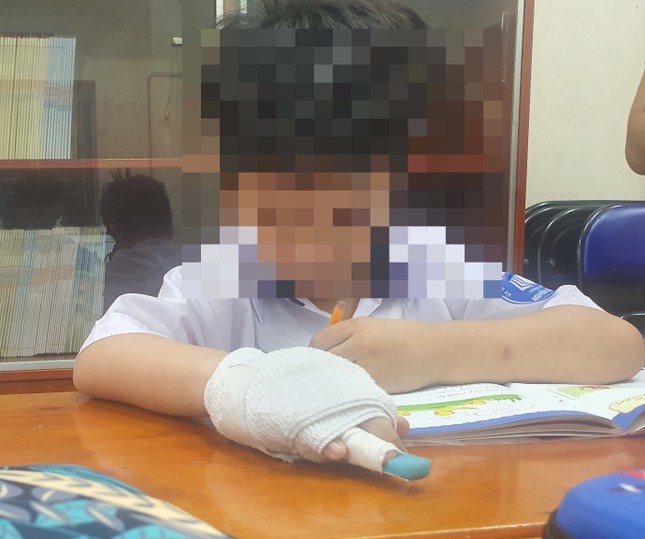 Tạm đình chỉ giáo viên đánh gãy ngón tay học sinh - Ảnh 2.