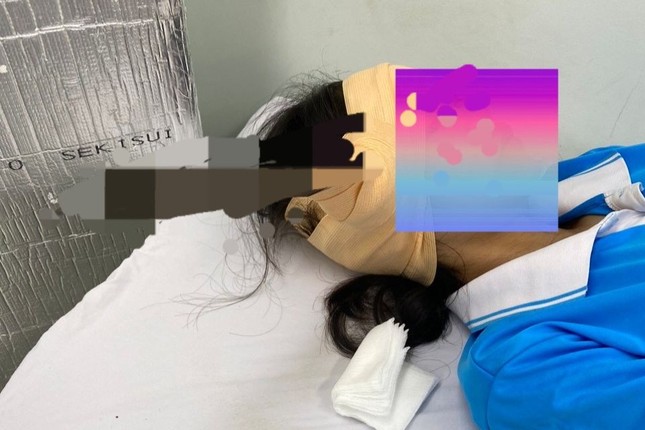 Nữ sinh bị lưỡi dao găm vào đầu khi ngồi uống nước trong sân trường - Ảnh 1.