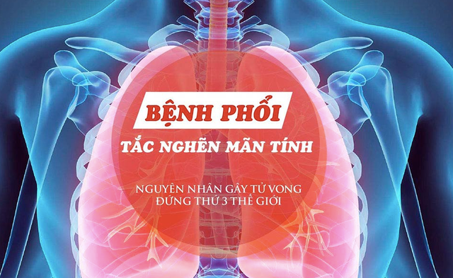 PGS.TS.BS Lê Thị Tuyết Lan: Bệnh phổi tắc nghẽn mãn tính là nguyên nhân gây tử vong xếp hàng thứ 3 - Ảnh 2.