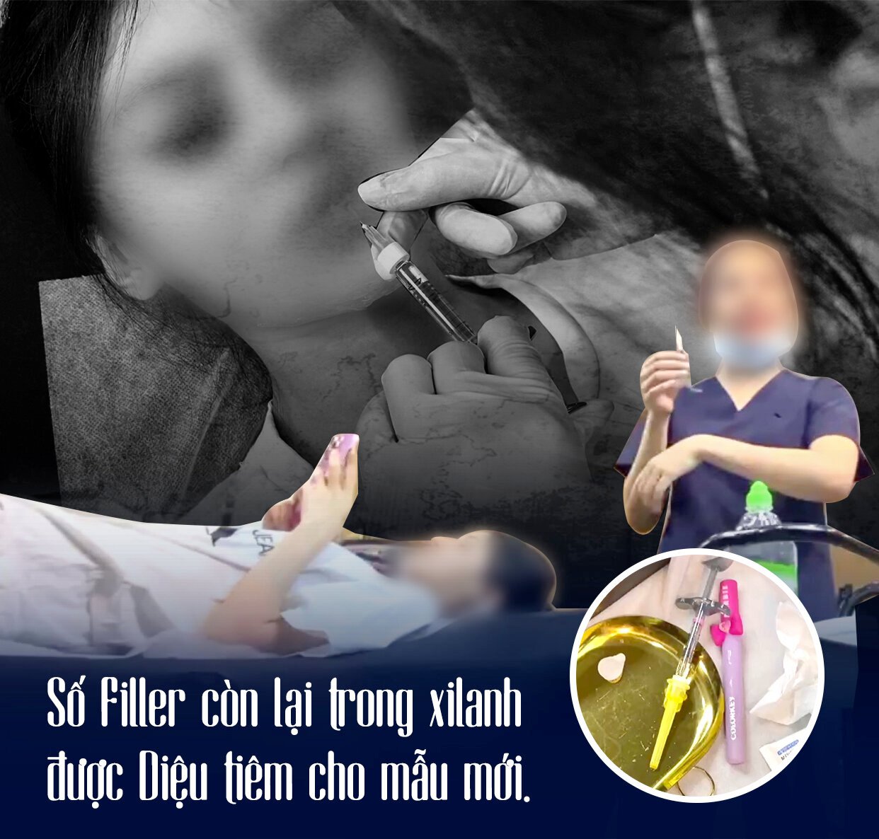 Trong “lò” đào tạo tiêm filler chui: “Mình tiêm gì lên mặt nó sao nó biết mà lo” - Ảnh 8.