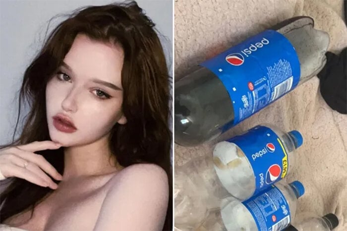 Cô gái nghiện Pepsi đến mức uống 4 lít mỗi ngày. Nếu cô ấy không uống nó, cô ấy sẽ bị bệnh nặng
