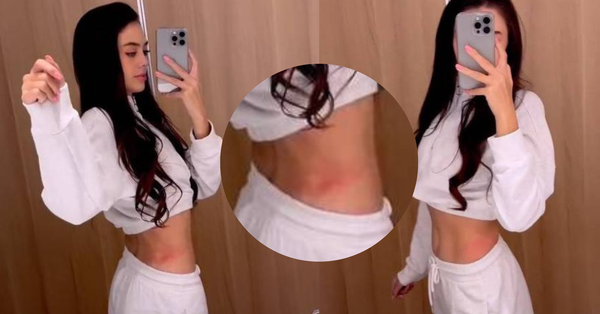 Vợ Tây của Bùi Tiến Dũng lộ vết hằn đỏ trên eo thon, tâm sự về nghề người mẫu - Ảnh 1.