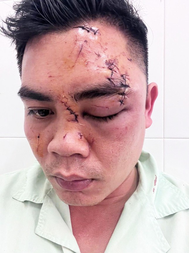 Ba ch&aacute;u b&eacute; g&agrave;o kh&oacute;c, cầu cứu khi người cha bất ngờ bị đ&aacute;nh d&atilde; man tại nh&agrave; h&agrave;ng - Ảnh 2.