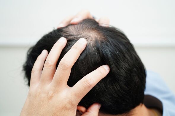 Rụng lông tóc ở ba vùng trên cơ thể có thể là dấu hiệu của bệnh truyền nhiễm - Ảnh 1.