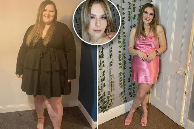 Cô gái giảm cân gần 100kg khi bác sĩ nghiêm túc nhắc nhở giảm cân thì sống - Ảnh 1.