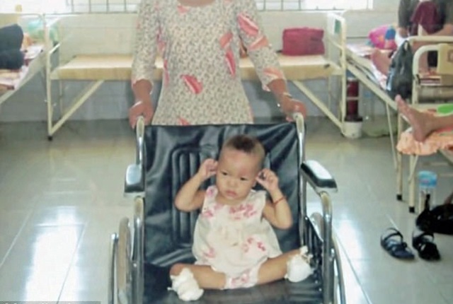 Cuộc sống hiện tại của bé gái gốc Việt bị bố mẹ nổ bom mất 2 chân: Được báo chí thế giới gọi là nữ kình ngư thần kỳ, trở thành đại sứ truyền cảm hứng cho những người khuyết tật - Ảnh 3.