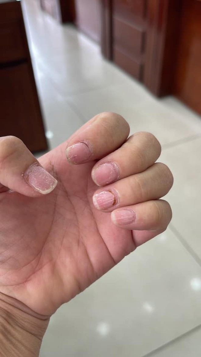 Sự thật kinh hoàng dưới những bộ nail xinh lung linh của hội chị em - Ảnh 6.