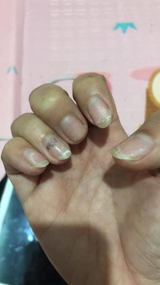 Sự thật kinh hoàng dưới những bộ nail xinh lung linh của hội chị em - Ảnh 5.