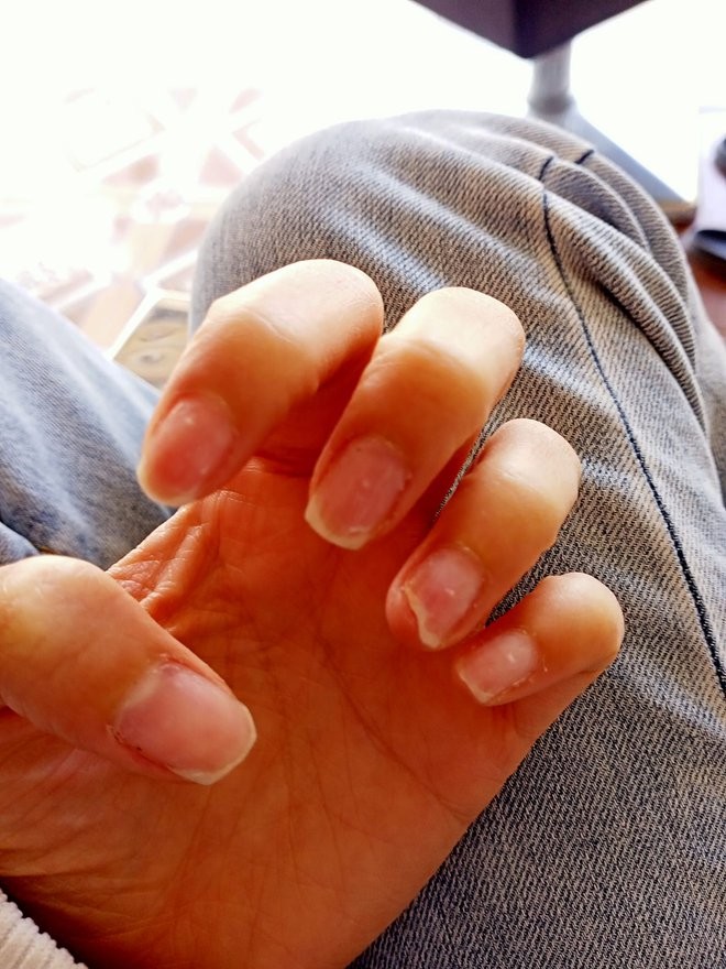 Sự thật kinh hoàng dưới những bộ nail xinh lung linh của hội chị em - Ảnh 12.