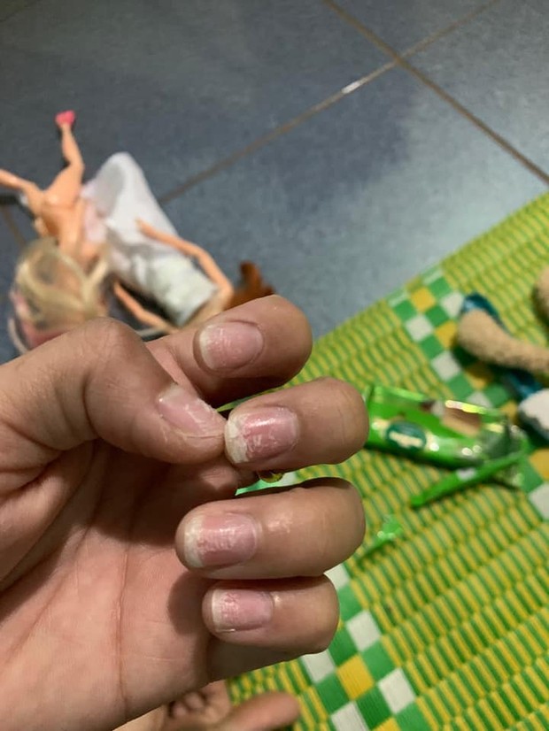 Sự thật kinh hoàng dưới những bộ nail xinh lung linh của hội chị em - Ảnh 9.