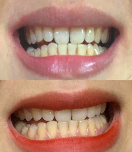 Trải nghiệm 1 tháng dùng tinh dầu trắng răng: Kết quả không như là mơ - Ảnh 7.