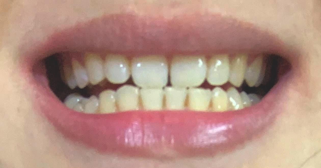 Trải nghiệm 1 tháng dùng tinh dầu trắng răng: Kết quả không như là mơ - Ảnh 5.
